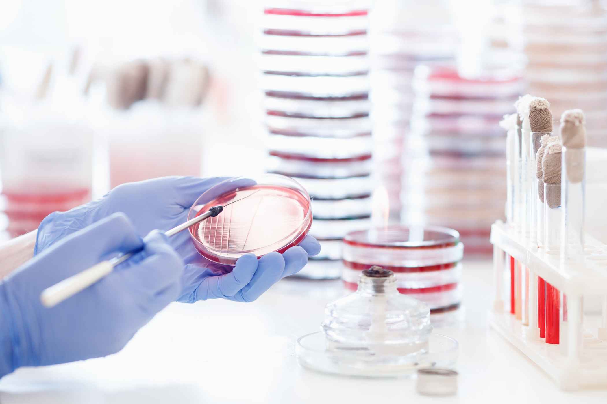 Antimicrobial Fabrics: The Future of Textiles Antimicrobial Fabrics: The Future of Textiles