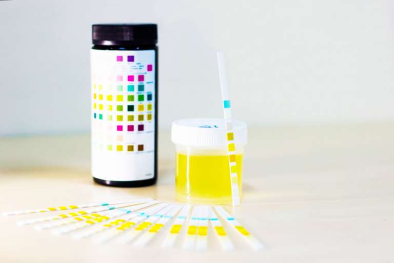 LabDip Approval For Dyeing And It's Purposes